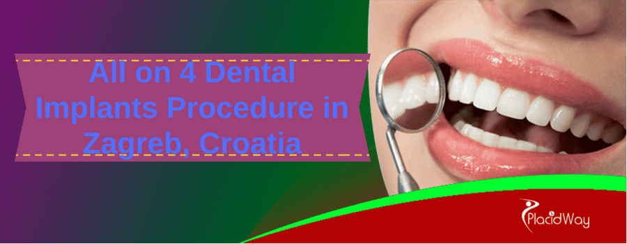 All on 4 Dental Implants Procedure in Zagreb, Croatia